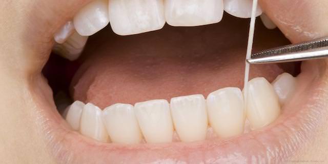 OroTox: Tote Zähne auf Gifte testen